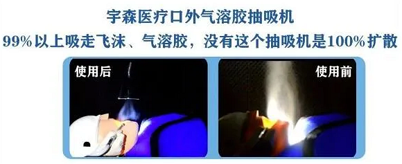 宇森口外氣溶膠抽吸機