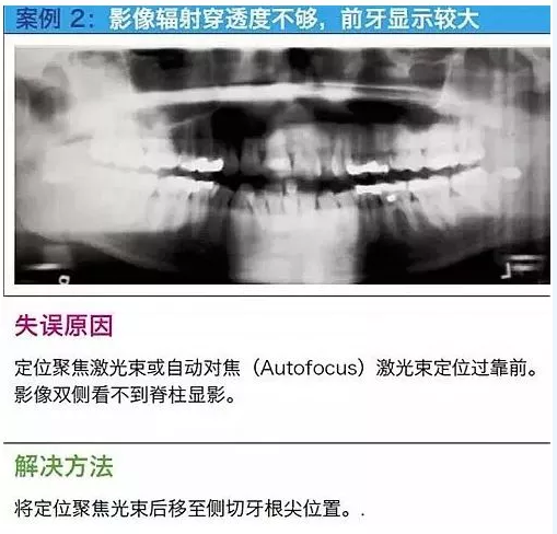 曲斷的10大經(jīng)典失誤案例及原因分析！