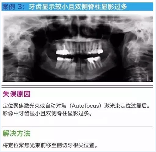 曲斷的10大經(jīng)典失誤案例及原因分析！