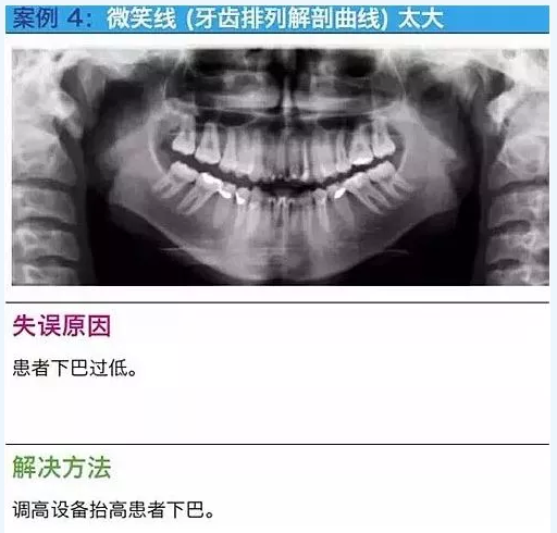 曲斷的10大經(jīng)典失誤案例及原因分析！