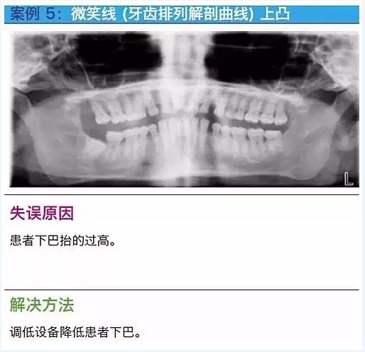 曲斷的10大經(jīng)典失誤案例及原因分析！