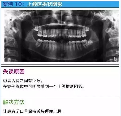 曲斷的10大經(jīng)典失誤案例及原因分析！