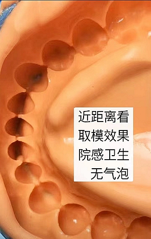 ?？抵Z德藻酸鹽印模材料