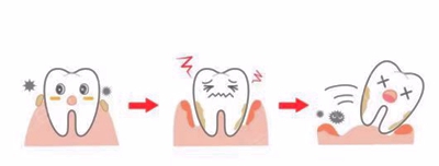牙周病總是來勢洶洶？有辦法預(yù)防嗎？